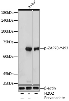 Phospho-ZAP70-Y493 Polyclonal Antibody