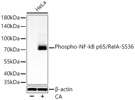 Phospho-NF-kB p65/RelA-S536 Polyclonal Antibody