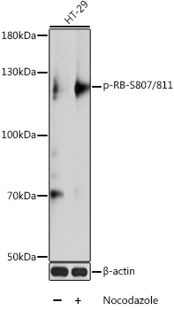 Phospho-RB-S807/811 Polyclonal Antibody