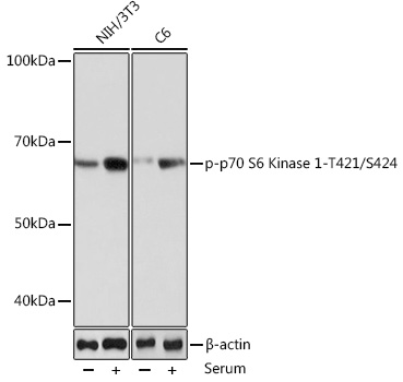 Phospho-p70 S6 Kinase 1-T421/S424 Monoclonal Antibody [0Y3C7]