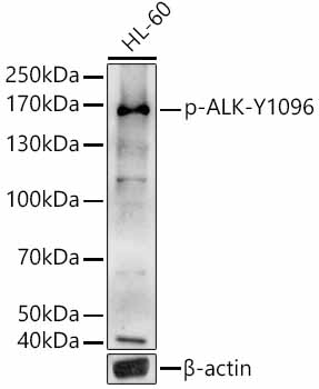 Phospho-ALK-Y1096 Polyclonal Antibody