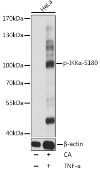Phospho-IKKa-S180 Polyclonal Antibody