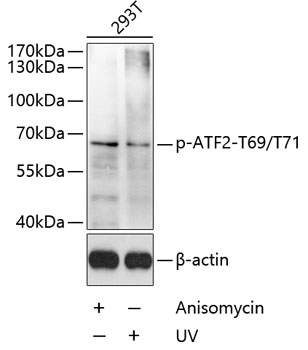 Phospho-ATF2-T69/T71 Polyclonal Antibody