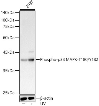 Phospho-p38 MAPK-T180/Y182 Polyclonal Antibody