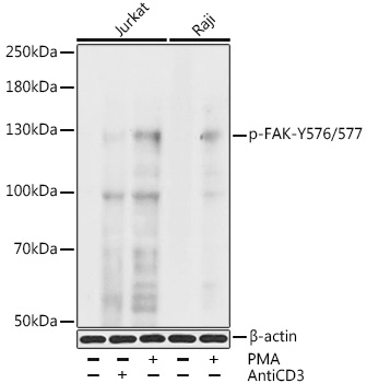Phospho-FAK-Y576/577 Polyclonal Antibody