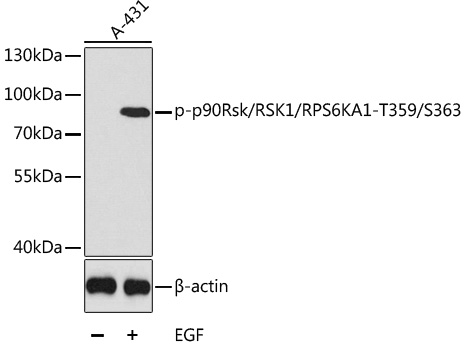 Phospho-p90Rsk/RSK1/RPS6KA1-T359/S363 Polyclonal Antibody