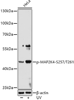 Phospho-MAP2K4-S257/T261 Polyclonal Antibody