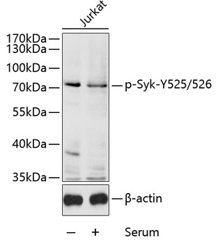 Phospho-Syk-Y525/526 Polyclonal Antibody