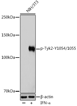 Phospho-Tyk2-Y1054/1055 Polyclonal Antibody
