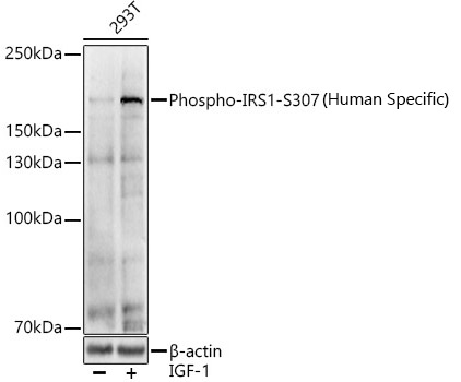 Phospho-IRS1-S307(Human Specific) Polyclonal Antibody