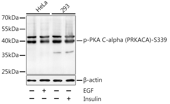 Phospho-PKA C-alpha (PRKACA)-S339 Polyclonal Antibody