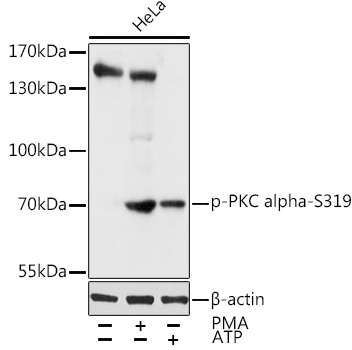 Phospho-PKC alpha-S319 Polyclonal Antibody