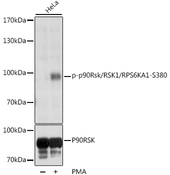 Phospho-p90Rsk/RSK1/RPS6KA1-S380 Polyclonal Antibody