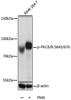 Phospho-PKC-delta/theta-S643/676 Polyclonal Antibody