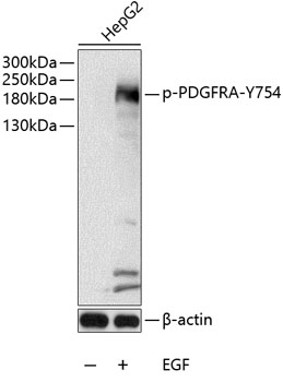 Phospho-PDGFR alpha-Y754 Polyclonal Antibody