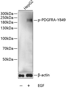 Phospho-PDGFR alpha-Y849 Polyclonal Antibody