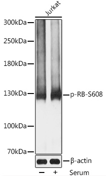 Phospho-RB-S608 Polyclonal Antibody