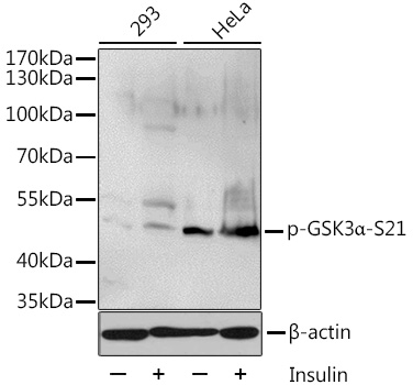 Phospho-GSK3a-S21 Polyclonal Antibody