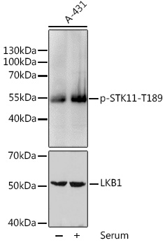 Phospho-STK11-T189 Polyclonal Antibody