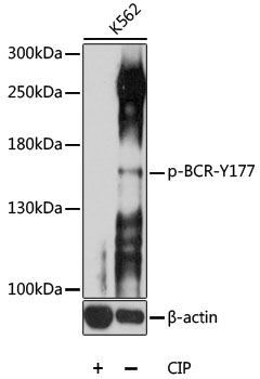 Phospho-BCR-Y177 Polyclonal Antibody