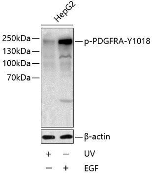 Phospho-PDGFR alpha-Y1018 Polyclonal Antibody