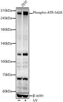 Phospho-ATR-S428 Polyclonal Antibody