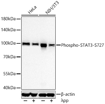 Phospho-STAT3-S727 Monoclonal Antibody [4Z6R6]