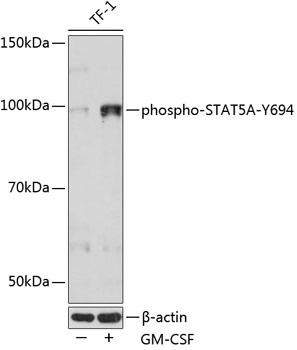 Phospho-STAT5A-Y694 Monoclonal Antibody [10F6Q4]