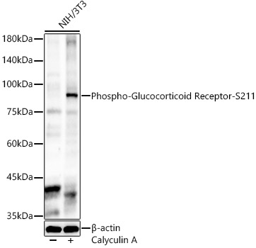 Phospho-Glucocorticoid Receptor-S211 Polyclonal Antibody