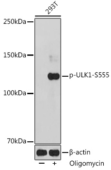 Phospho-ULK1-S555 Polyclonal Antibody