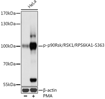 Phospho-p90Rsk/RSK1/RPS6KA1-S363 Polyclonal Antibody