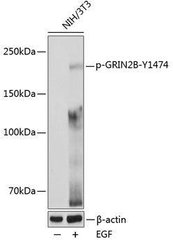 Phospho-GRIN2B-Y1474 Polyclonal Antibody
