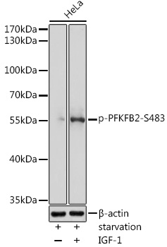 Phospho-PFKFB2-S483 Polyclonal Antibody