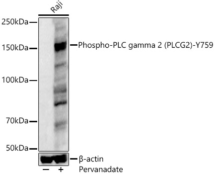 Phospho-PLC gamma 2 (PLCG2)-Y759 Polyclonal Antibody