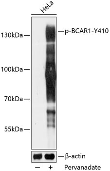 Phospho-BCAR1-Y410 Polyclonal Antibody