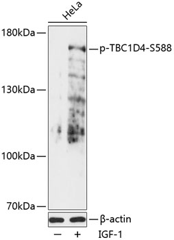 Phospho-TBC1D4-S588 Polyclonal Antibody