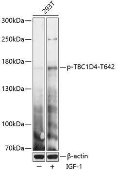Phospho-TBC1D4-T642 Polyclonal Antibody