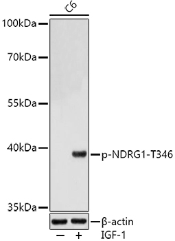 Phospho-NDRG1-T346 Polyclonal Antibody