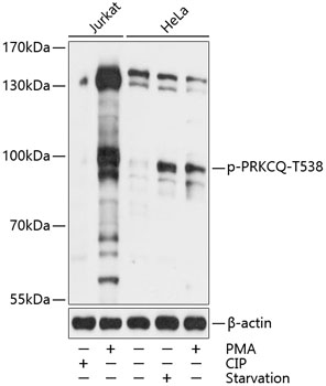 Phospho-PRKCQ-T538 Polyclonal Antibody