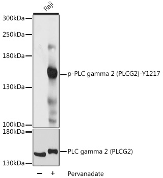 Phospho-PLC gamma 2 (PLCG2)-Y1217 Polyclonal Antibody