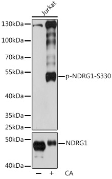 Phospho-NDRG1-S330 Polyclonal Antibody