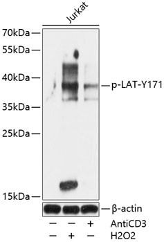 Phospho-LAT-Y171 Polyclonal Antibody