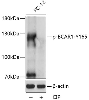Phospho-BCAR1-Y165 Polyclonal Antibody