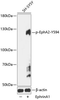 Phospho-EPHA2-Y594 Polyclonal Antibody