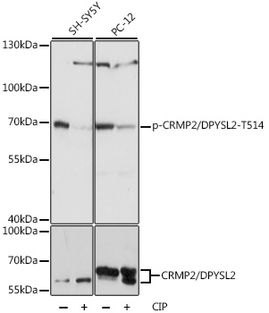 Phospho-CRMP2/DPYSL2-T514 Polyclonal Antibody