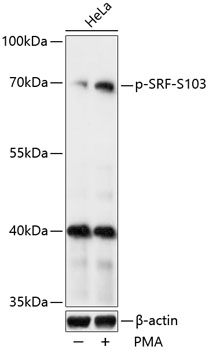 Phospho-SRF-S103 Polyclonal Antibody