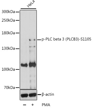 Phospho-PLC beta 3 (PLCB3)-S1105 Polyclonal Antibody