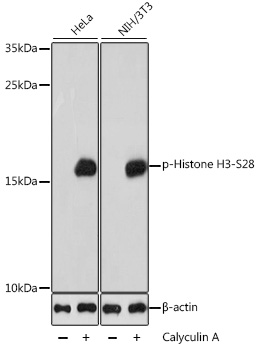 Phospho-Histone H3-S28 Polyclonal Antibody