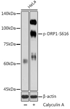 Phospho-DRP1-S616 Polyclonal Antibody