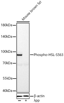 Phospho-HSL-S563 Polyclonal Antibody